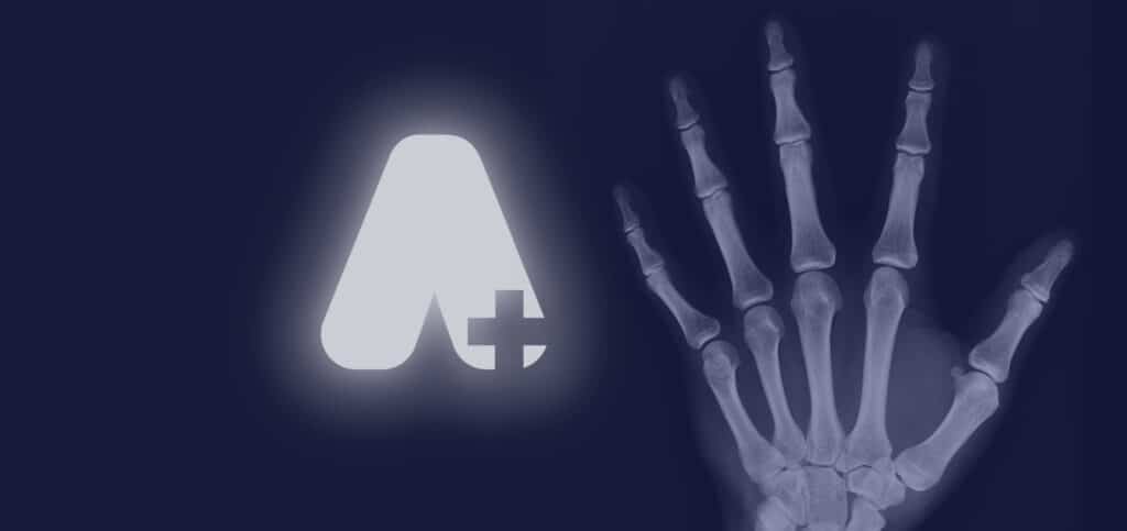 3 Benefits Of Getting An X-ray At Our Walk In Clinic - Aspira Health